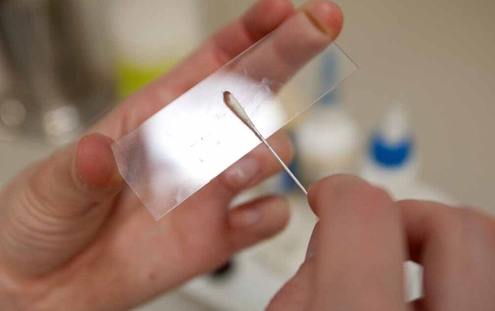 scraping due to the presence of parasites in the body