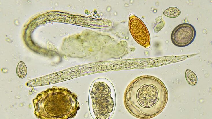 types of human parasites