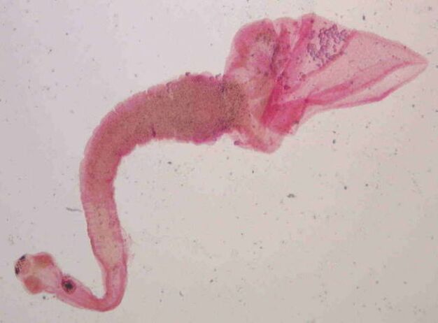 human pig tapeworm