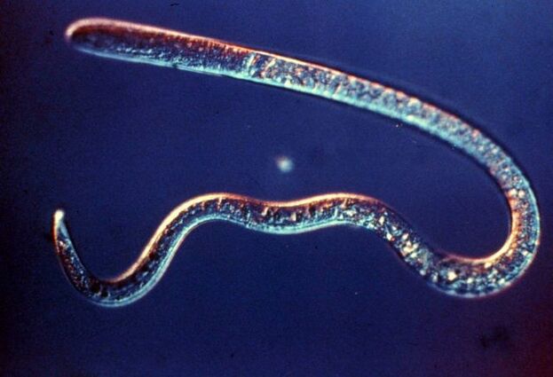 trichinella of the human body