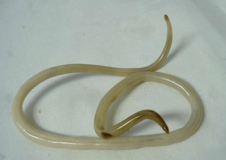 human body worm and its treatment