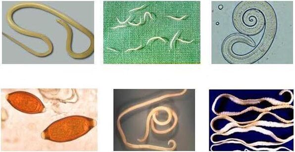 Worms that can infect the human body.