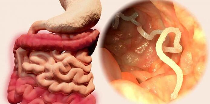The worm is a parasite in humans.
